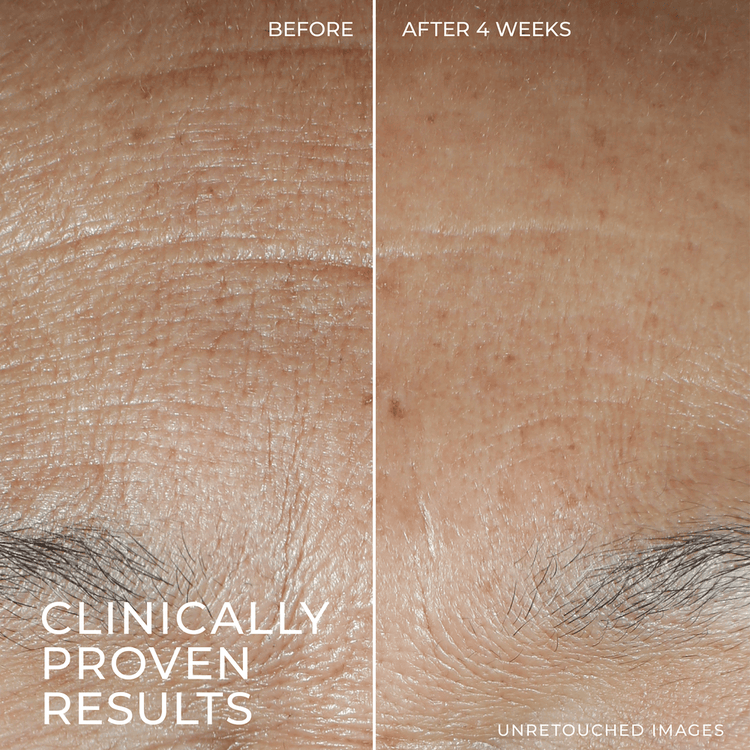 Multi Correxion Hydration+ Suero hidratante rellena y suaviza líneas de expresión