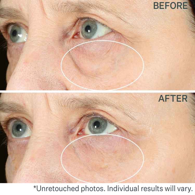 Hyperlift Eye Instant Eye Fix For Bags, Lines & Crepiness Tratamiento reafirma la zona de los ojos