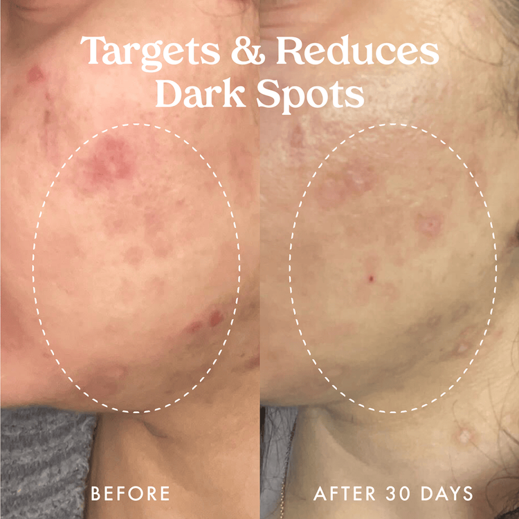 Star Bright Vitamin C - Suero antimanchas, hidrata la piel