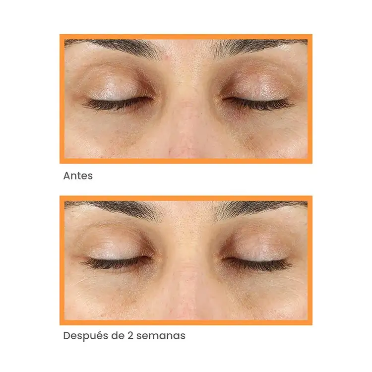 Antimanchas - Vita-C Eyes Dark Circle Corrector Suero de ojos combate las ojeras