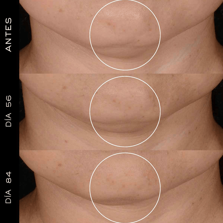 Rénergie Hpn 300 Peptide Refill Cream Crema hidrantante regenera la piel más rápido de lo que envejece