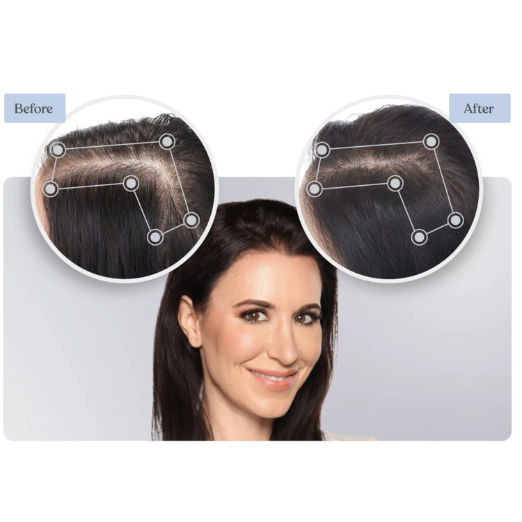 Hair Regrowth Sprayer for Women - 30 Day Supply Tratamiento capilar ayuda a regenerar el cabello