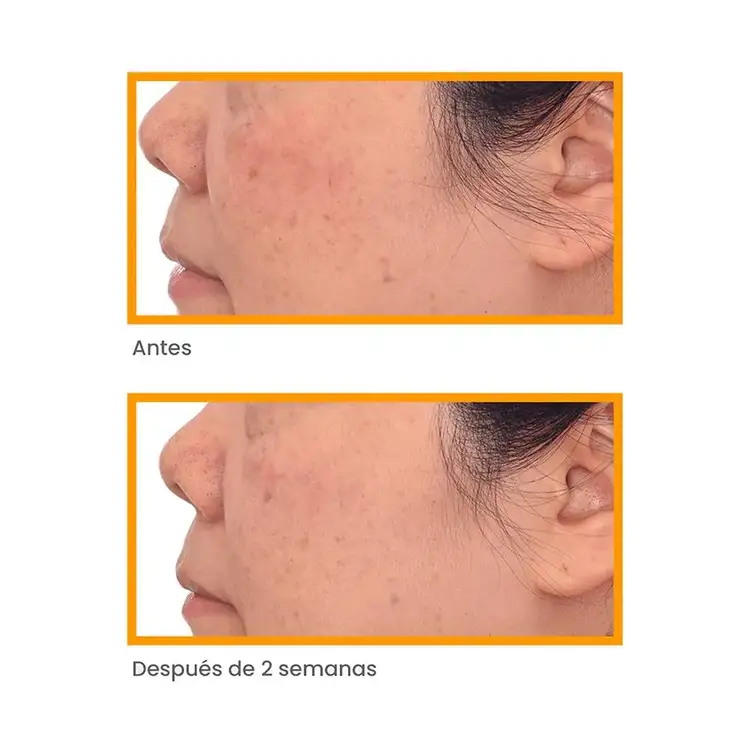 Manchas - Correct & Protect Serum Protector solar corrige a decoloración