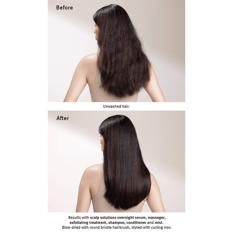 Scalp Advanced Estimulador de cuero cabelludo hidrata y cuida el cuero cabelludo