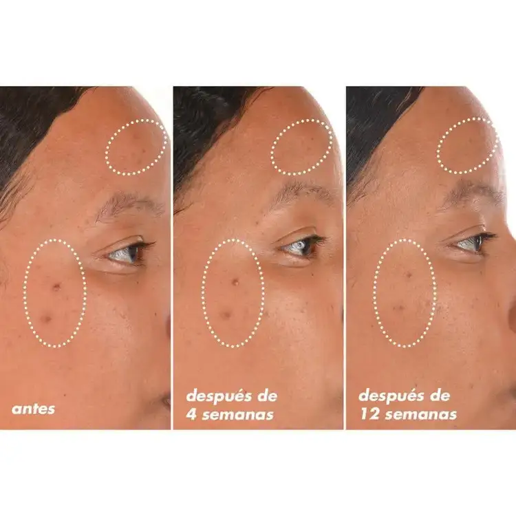 Bright Icon - Sérum facial iluminador, con 15% de vitamina C, 1% de vitamina E y 0.5% de ácido ferúlico