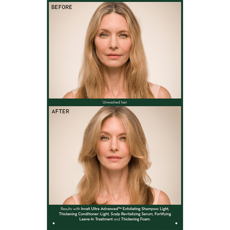 Invati Ultra Suero capilar evita la caída y engrosa el cabello