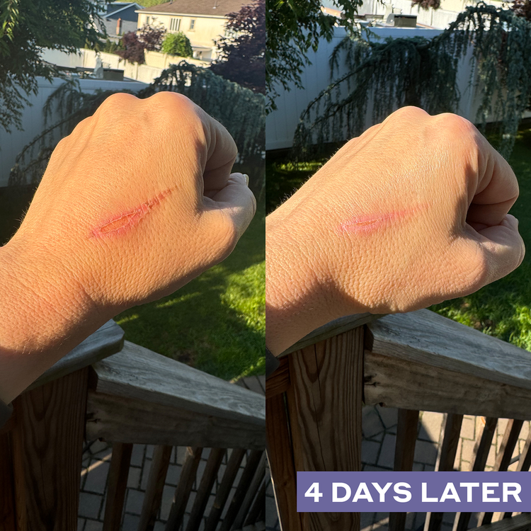 Hypochlorous Acid Spray facial reparador limpia las impurezas