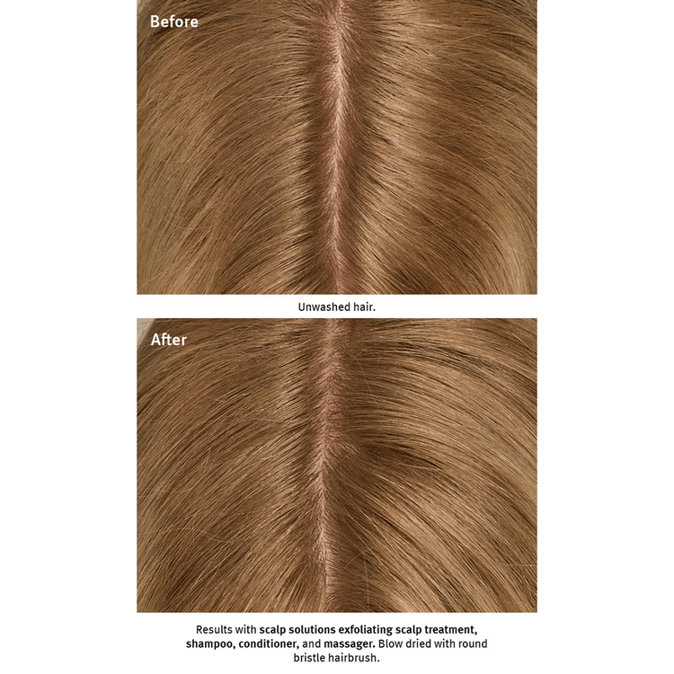 Scalp Advanced Estimulador de cuero cabelludo hidrata y cuida el cuero cabelludo