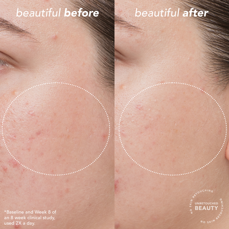 Bright Start Vitamin C Antioxidant Brightening Humectante mejora e ilumina el tono de la piel