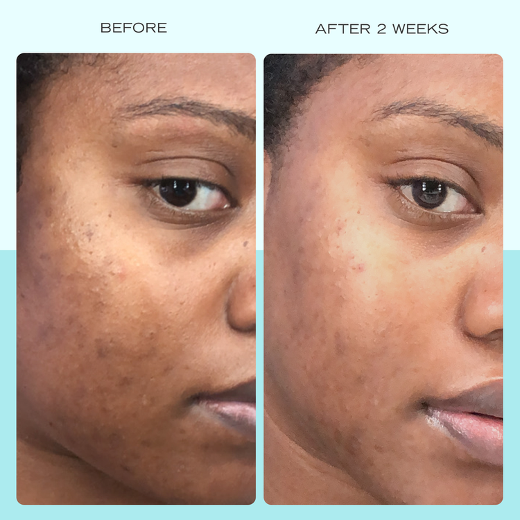 Facial Radiance Niacinamide Dark Spot Serum Suero facial antimanchas reduce manchas