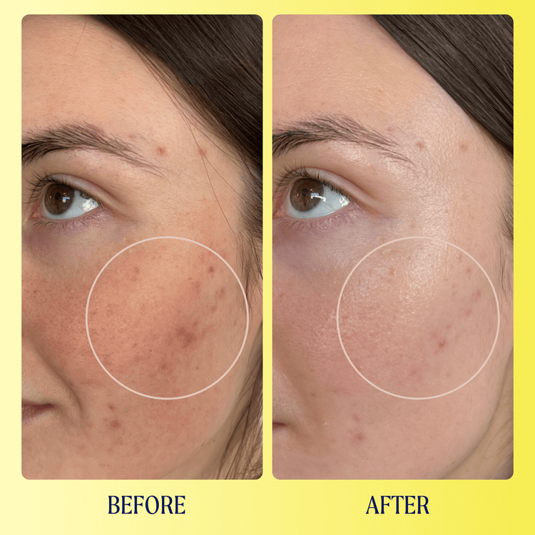 Brightwave 10% Vitamin C + Peptide Brightening Suero ilumina la piel