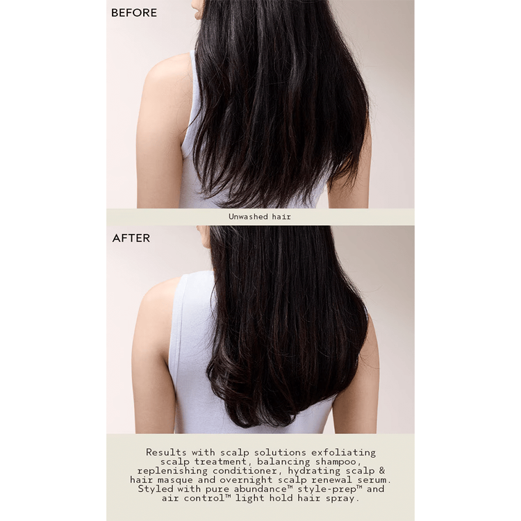 Scalp Advanced - Acondicionador, hidrata y cuida el cuero cabelludo