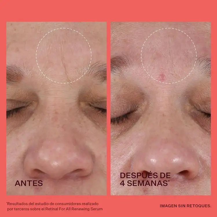 Ageless & Radiant - Set de regalo, ayuda a mejorar los signos de la piel