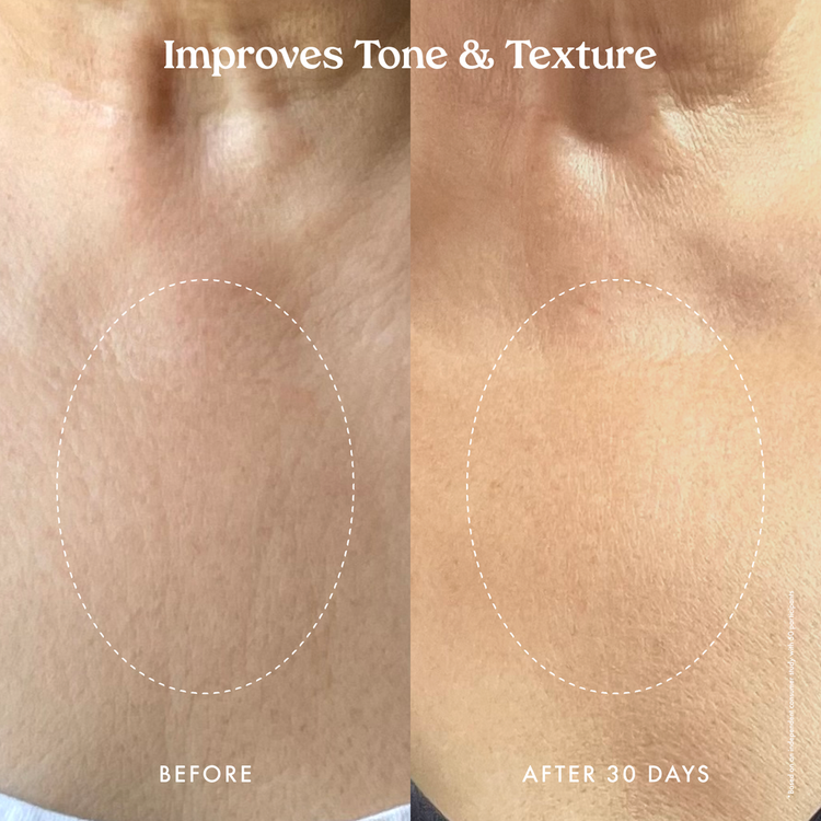 Ultra Restore - Suero corporal reafirmante, reafirma e hidrata la piel