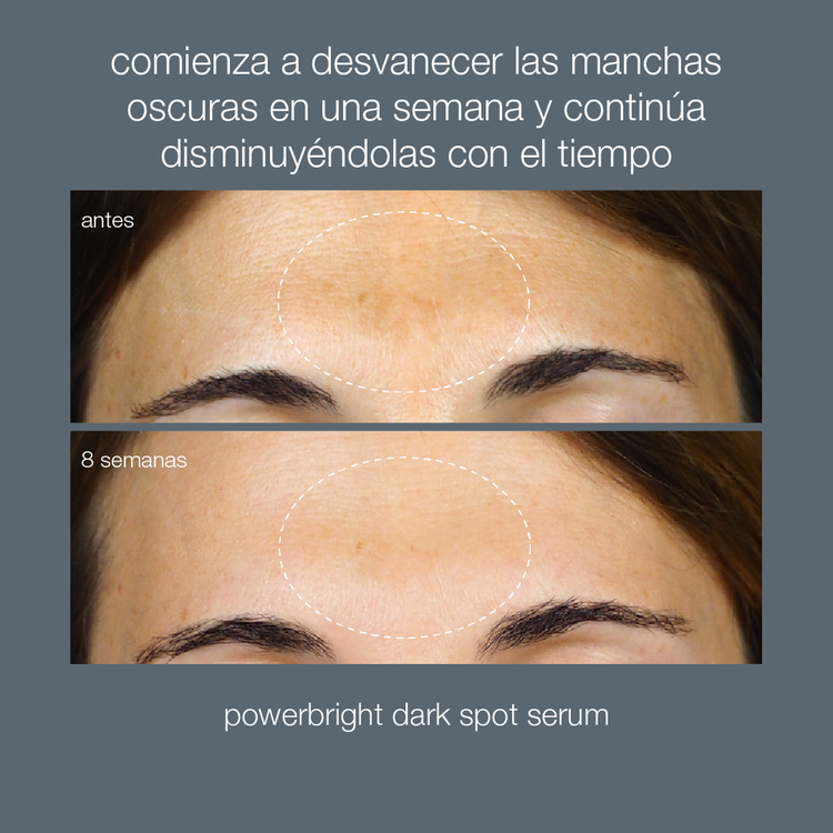 PowerBright Dark Spot Serum Suero atenúa manchas, iguala el tono, ilumina.