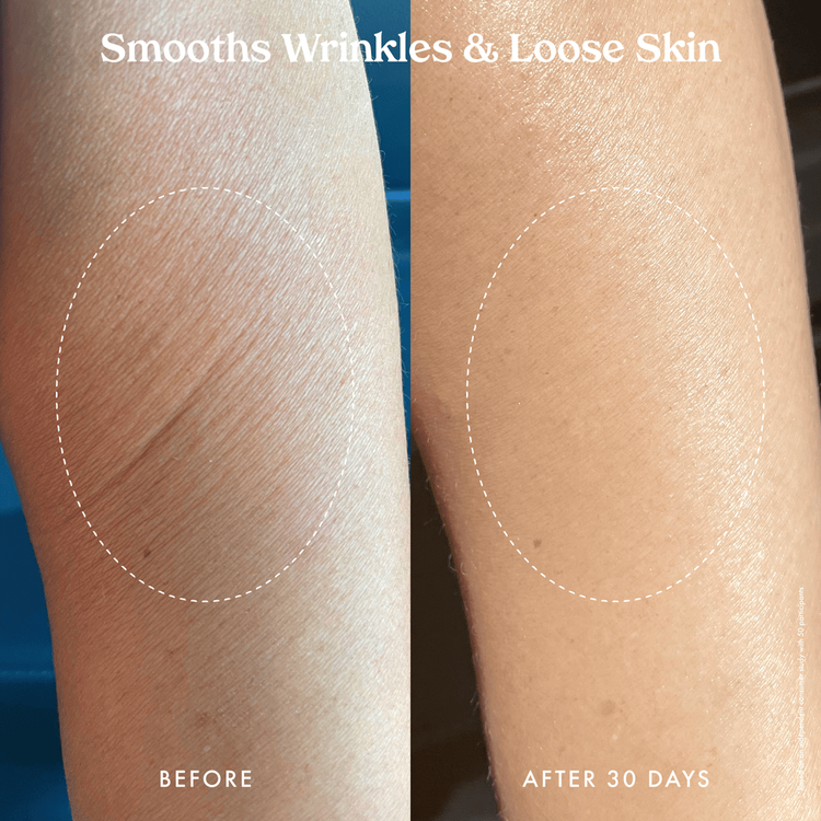 Ultra Renewal Retinol Crema corporal renovadora renueva e hidrata la piel