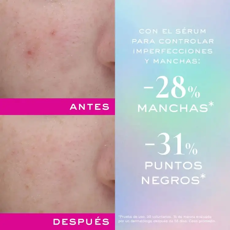 Power Zinc Serum sérum