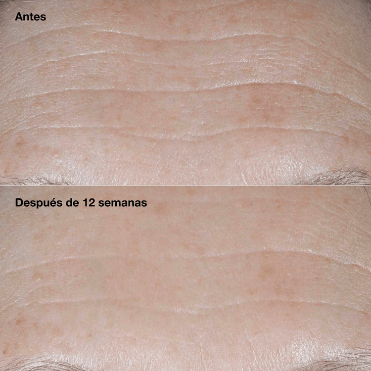 Smart Clinical Repair™ Wrinkle Correcting Cream Spf 50 Crema repara visiblemente las arrugas