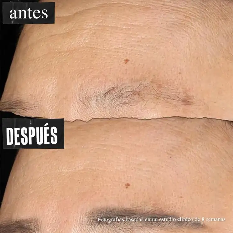 Super Multi-Corrective - Crema antiedad, corrige 7 signos clave del envejecimiento