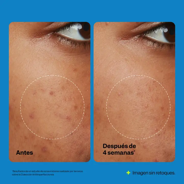 Blemish Oil-Free - Crema humectante, hidrata y suaviza la piel