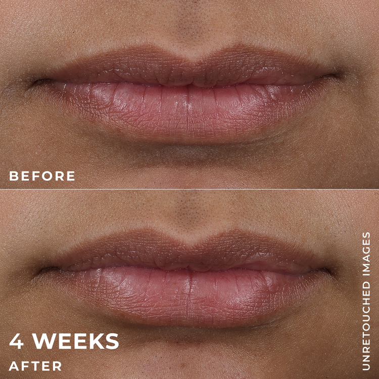 Derm Correxion Voluminizador de labios voluminiza los labios