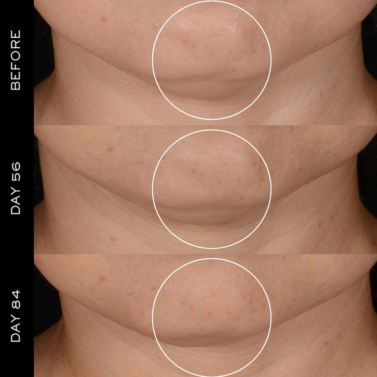 Rénergie Hpn 300 Peptide Cream Crema hidrantante regenera la piel más rápido de lo que envejece