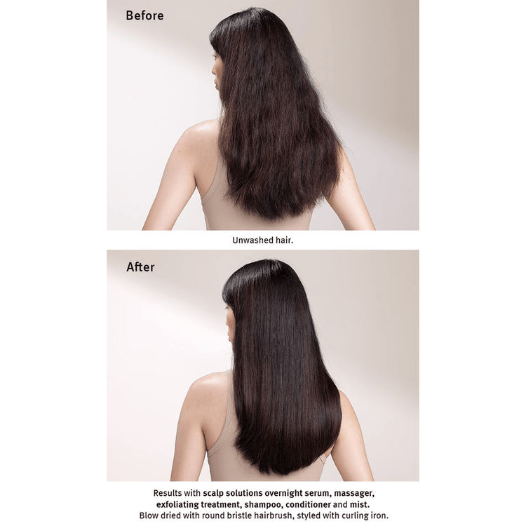 Scalp Advanced Mist protector para cabello hidrata y cuida el cuero cabelludo