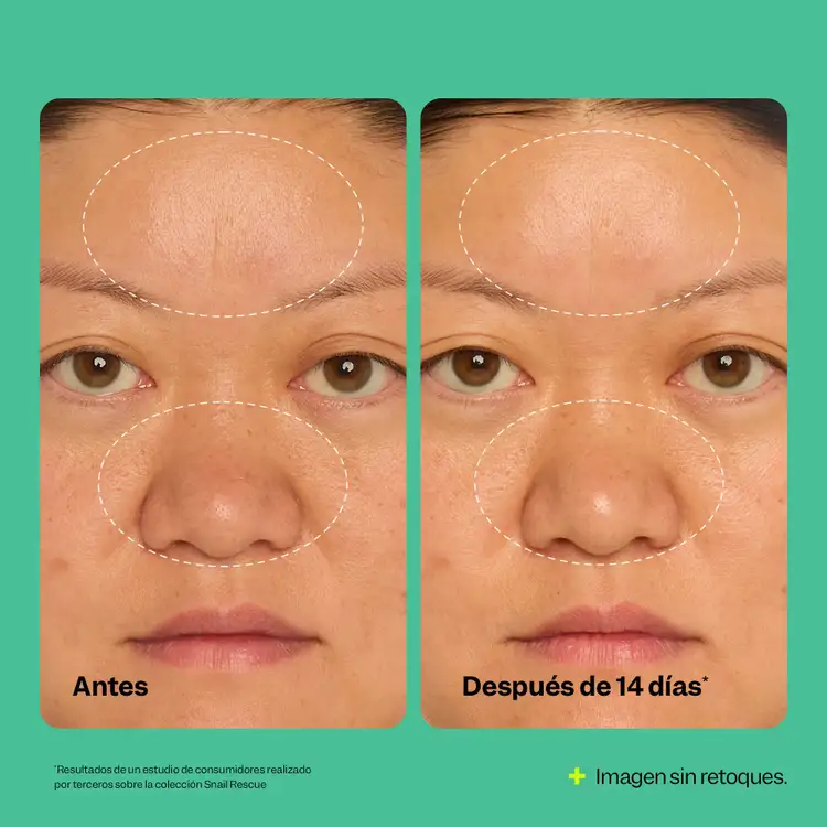 Snail Rescue All-In-One - Hidratante facial, hidratación profunda