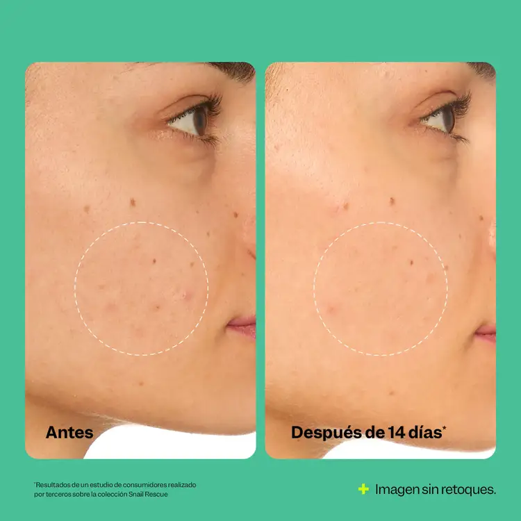 Snail Rescue - Mascarilla facial, hidrata y purifica la piel