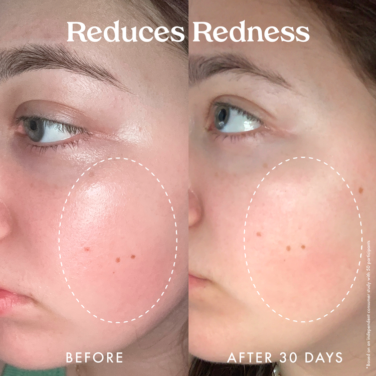 Star Bright Vitamin C Moisturizer Hidratante hidrata la piel