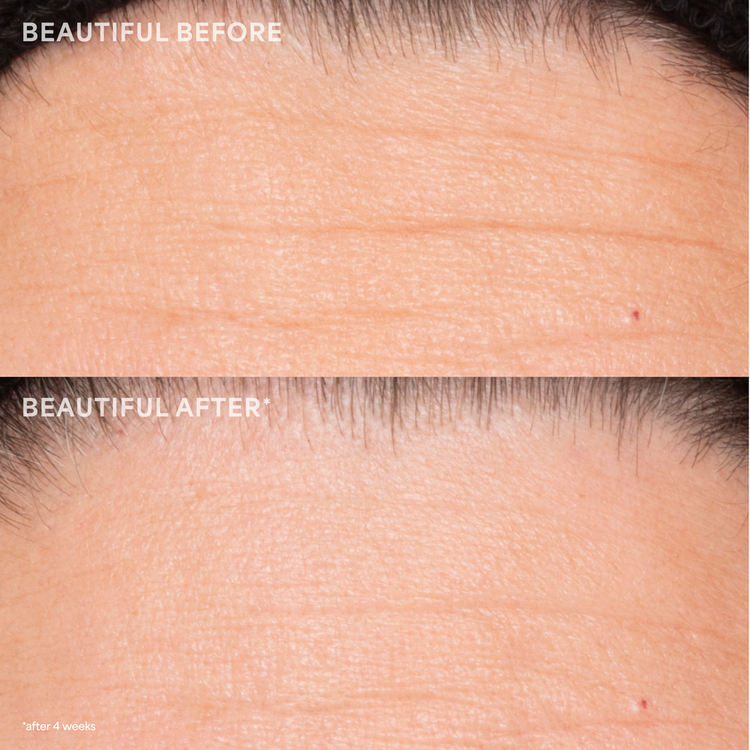 A+ Renewal Suero mejora la apariencia de arrugas