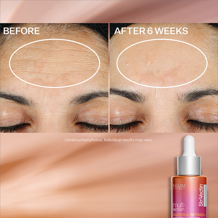 Super-C Retinol Brighten & Correct Vitamin C Suero iluminador ilumina la piel