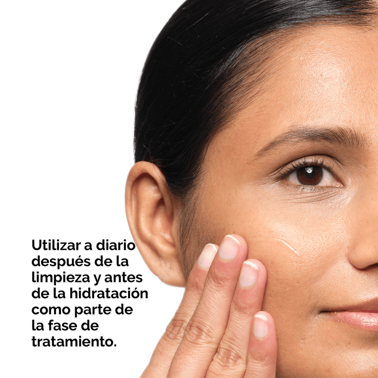 Aloe 2% + Nag 2% - Solución post acné, para pieles propensas a imperfecciones