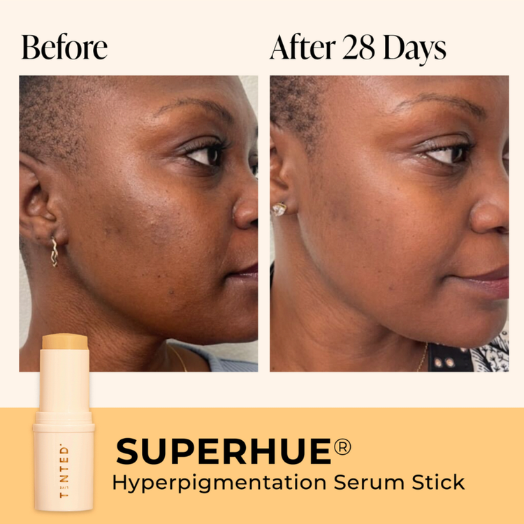 Superhue Hyperpigmentation Suero en barra reduce apariencia de manchas
