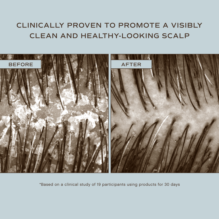 Hair Renew Baño capilar para el cuero cabelludo para todo tipo de cabello