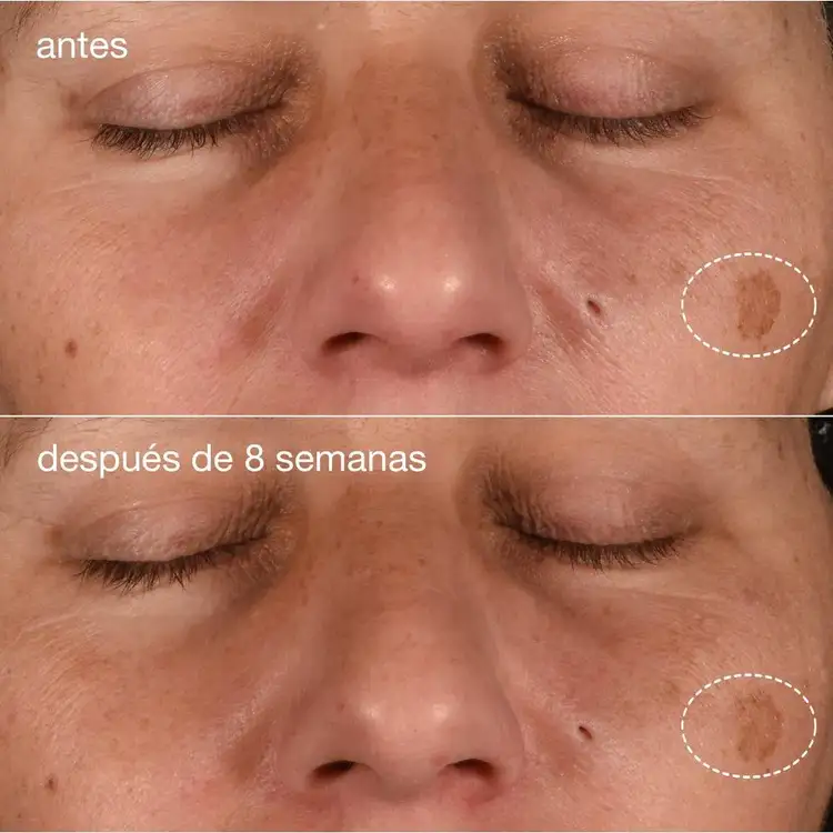 Dynamic Skin Recovery SPF 50 Moisturizer Protector solar firmeza e hidratación de la piel