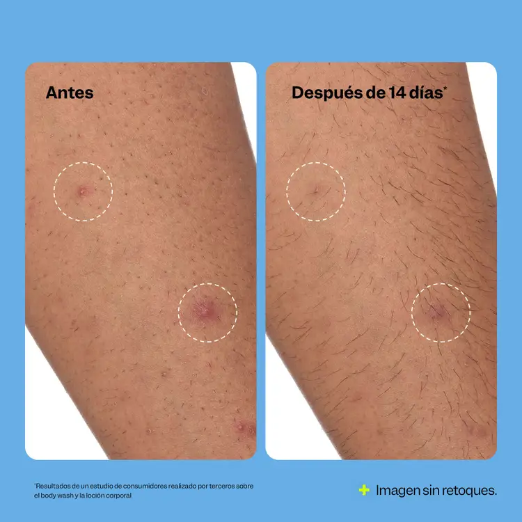 Breakout Banisher - Crema corporal, deja una piel suave