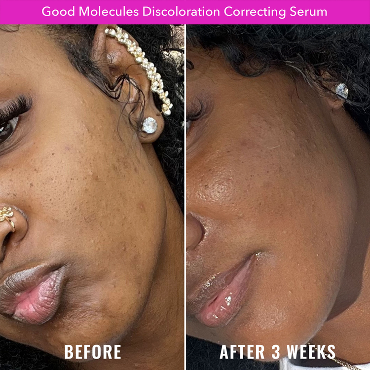 Discoloration Correcting - Suero facial, corrige manchas y unifica el tono de piel