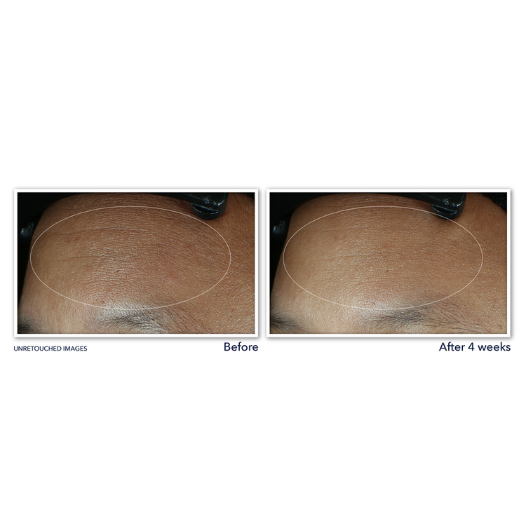 Retinol Correxion Max Daily Hydration Crema hidratante rellena y suaviza líneas de expresión