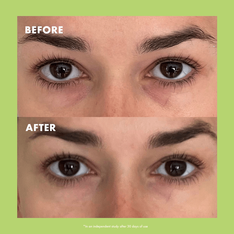 Niacinamide & Caffeine Crema para ojos reduce apariencia de ojeras