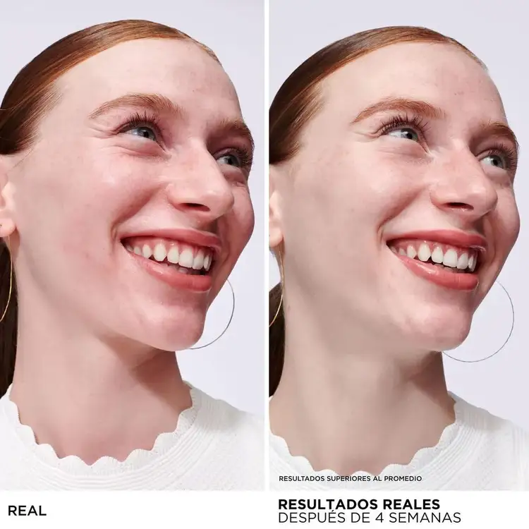 Bye Bye Serum Suero facial reduce rojeces rápido y refuerza la hidratación