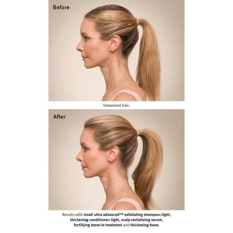 Invati Ultra Espuma evita la caida del cabello y engrosa la fibra capilar