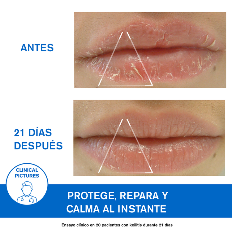 Bariederm Bálsamo labial