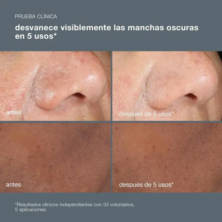 PowerBright Dark Spot Peel Peeling para manchas oscuras desvanece manchas oscuras