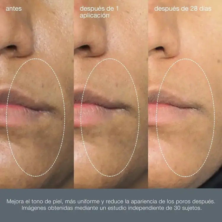 Liquid Peelfoliant Exfoliator with AHA BHA & PHA Exfoliante minimiza los poros