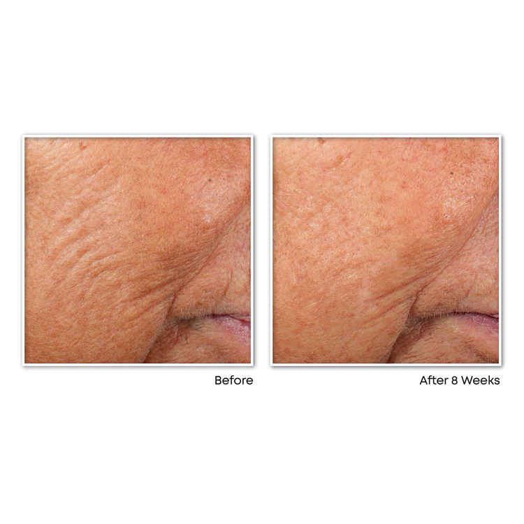 Retinol Correxion Line Smoothing Night Cápsulas revitaliza la piel