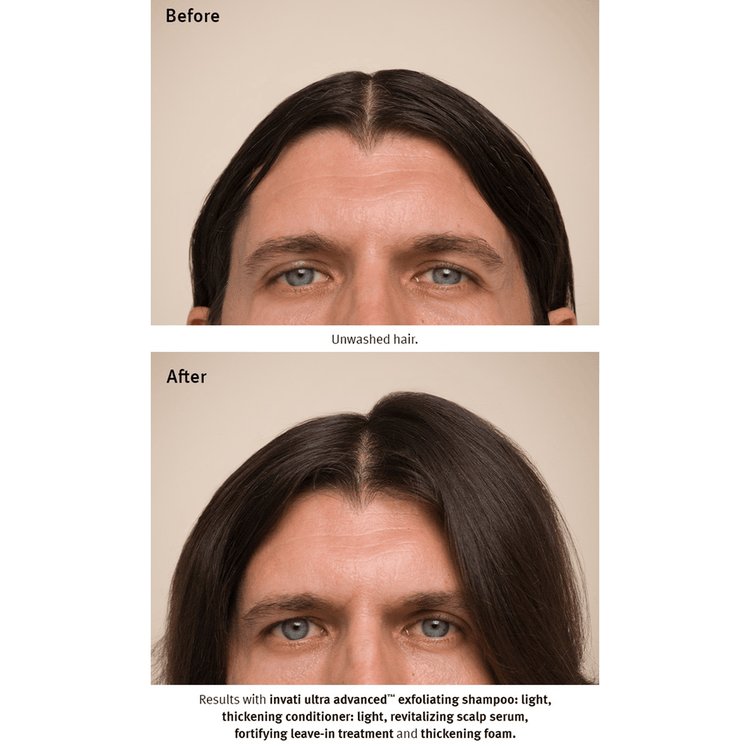 Invati Ultra Suero evita la caida del cabello y engrosa la fibra capilar