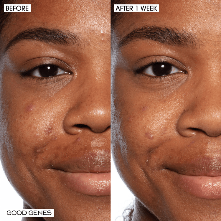 Instant Gratification - Set de regalo, potencia la luminosidad