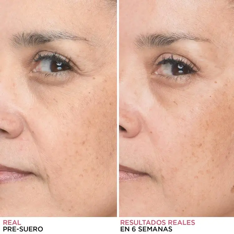 Bye Bye Serum Suero facial apto para todo tipo de pieles