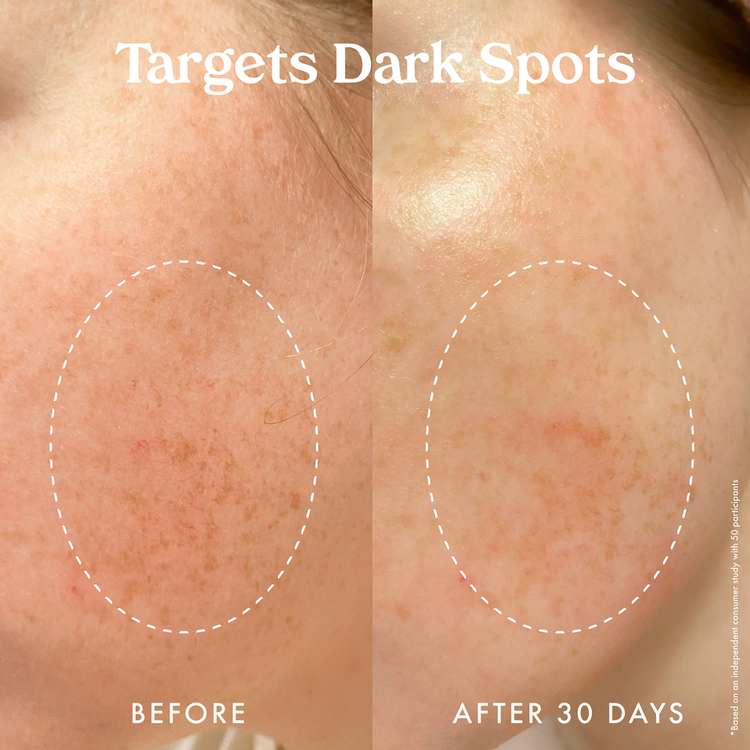 Star Bright Vitamin C Moisturizer Hidratante hidrata la piel